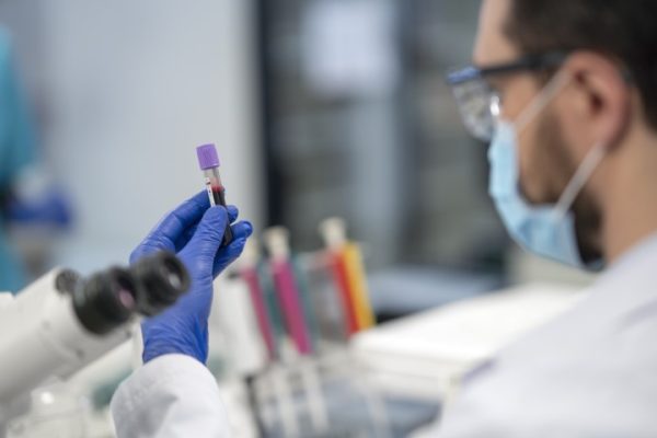 Exame Laboratoriais